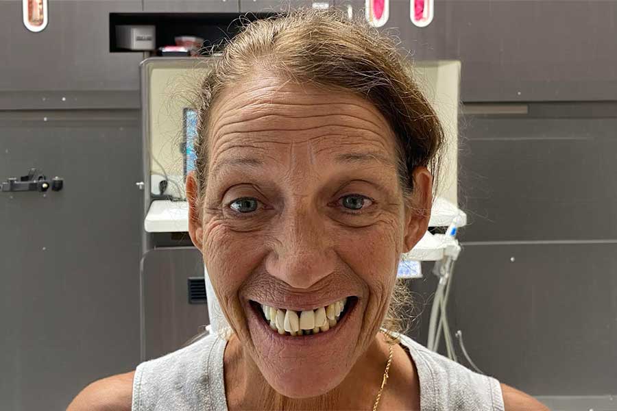 Patient transformation 4 before